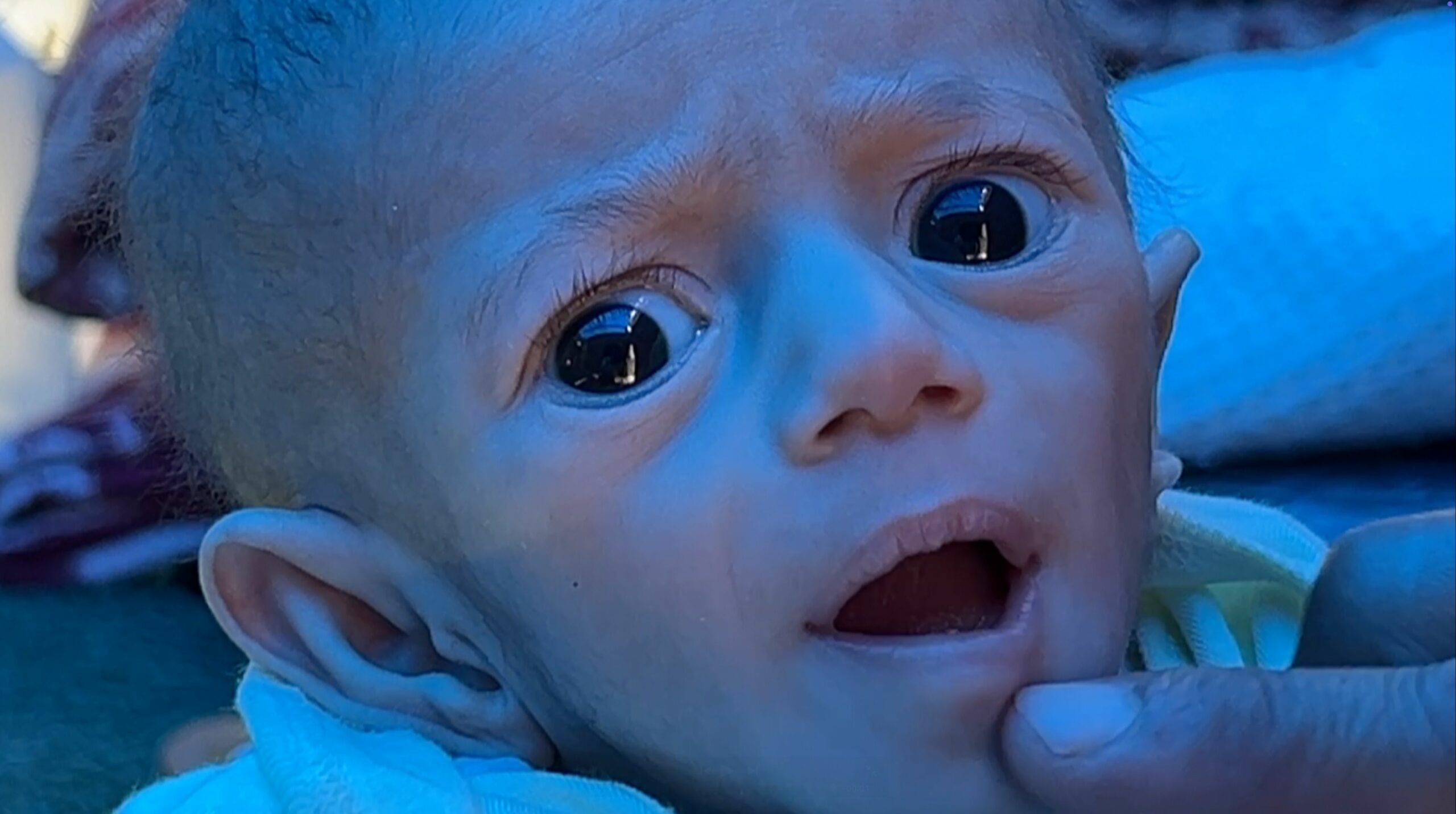 ‘Situation is dire’ – BBC returns to Gaza baby left hungry by Israeli blockade ‘Situation is dire’ – BBC returns to Gaza baby left hungry by Israeli blockade